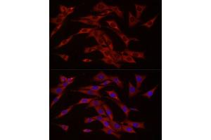 Immunofluorescence analysis of NIH/3T3 cells using cGAS Rabbit pAb (ABIN6134073, ABIN6143590, ABIN6143591 and ABIN6224360) at dilution of 1:50 (40x lens). (C6orf150 抗体  (AA 350-522))
