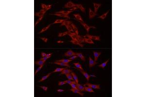 Immunofluorescence analysis of NIH/3T3 cells using cGAS Rabbit pAb (ABIN6134073, ABIN6143590, ABIN6143591 and ABIN6224360) at dilution of 1:50 (40x lens). (C6orf150 抗体  (AA 350-522))