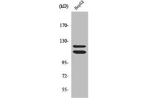 Western Blot analysis of HepG2 cells using NY-CO-9 Polyclonal Antibody (HDAC5 抗体  (C-Term))