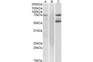 HEK293 lysate (10ug protein in RIPA buffer) overexpressing Human (ITK) with DYKDDDDK tag probed with ABIN184605 (1ug/ml) in Lane A and probed with anti-DYKDDDDK Tag (1/10000) in lane C. (ITK 抗体  (C-Term))