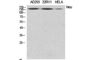 Western Blot analysis of various cells using ERBB2 Polyclonal Antibody at dilution of 1:2000. (ErbB2/Her2 抗体)