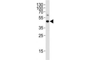 C9orf72 antibody western blot analysis in WiDr cell lysate (C9ORF72 抗体  (AA 396-424))