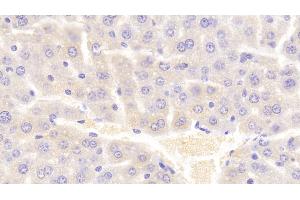 Detection of VAV1 in Mouse Liver Tissue using Polyclonal Antibody to Vav 1 Oncogene (VAV1) (VAV1 抗体  (AA 565-795))