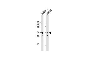 All lanes : Anti-GNB1 Antibody (N-term) at 1:1000 dilution Lane 1: human brain lysate Lane 2: Jurkat whole cell lysate Lysates/proteins at 20 μg per lane.