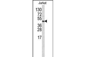 Western blot analysis of CPB2 antibody (Center ) (ABIN390451 and ABIN2840825) in Jurkat cell line lysates (35 μg/lane). (CPB2 抗体  (AA 119-148))