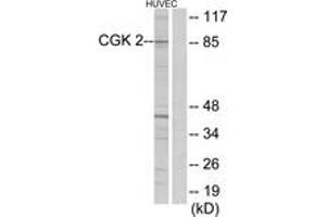 Western Blotting (WB) image for anti-Protein Kinase, CGMP-Dependent, Type II (PRKG2) (AA 391-440) antibody (ABIN2889570) (PRKG2 抗体  (AA 391-440))