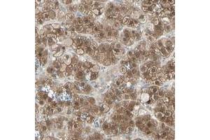 Immunohistochemical staining of human adrenal gland with LHPP polyclonal antibody  shows strong cytoplasmic positivity in cortical cells at 1:200-1:500 dilution. (LHPP 抗体)