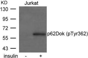 Western blot analysis of extracts from Jurkat cells untreated or treated with insulin using p62Dok(phospho-Tyr362) Antibody.