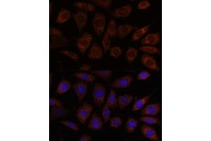 Immunofluorescence analysis of L929 cells using SEC24D antibody (ABIN7270171) at dilution of 1:100. (SEC24D 抗体  (AA 830-1000))