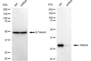 Western blotting analysis using PRKRA antibody (ABIN7800015). (Recombinant PRKRA 抗体)