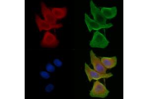 ABIN7095380 and ABIN7099437 staining Hela cells(45 min of heat-shock treatment) by IF/ICC. (VKORC1L1 抗体)
