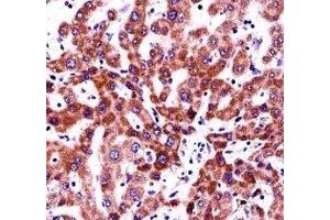 Integrin beta 5 antibody immunohistochemistry analysis in formalin fixed and paraffin embedded human liver tissue. (Integrin beta 5 抗体  (AA 216-244))