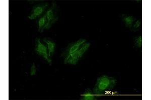 Immunofluorescence of monoclonal antibody to KSR2 on HeLa cell. (KSR2 抗体  (AA 411-500))
