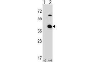 Western Blotting (WB) image for anti-Serine/threonine Kinase Receptor Associated Protein (STRAP) antibody (ABIN3001728)