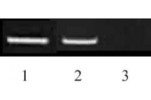 Histone H3 dimethyl Lys9 antibody tested by ChIP. (Histone 3 抗体  (H3K9me2))