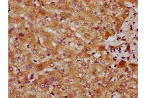 IHC image of ABIN7147604 diluted at 1:300 and staining in paraffin-embedded human liver tissue performed on a Leica BondTM system. (CYP7A1 抗体  (AA 303-423))
