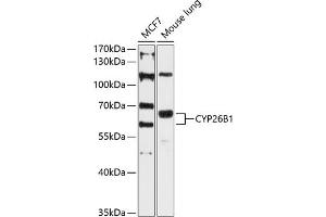 Western blot analysis of extracts of various cell lines, using CYP26B1 antibody (ABIN6130158, ABIN6139325, ABIN6139326 and ABIN6215727) at 1:3000 dilution. (CYP26B1 抗体  (AA 213-512))