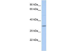 WB Suggested Anti-SCAND2 Antibody Titration:  0. (SCAND2 抗体  (N-Term))