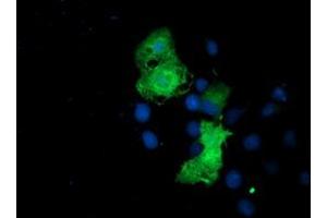 Anti-EPN2 mouse monoclonal antibody (ABIN2455554) immunofluorescent staining of COS7 cells transiently transfected by pCMV6-ENTRY EPN2 (RC213652). (Epsin 2 抗体)