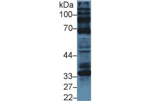 Western Blot; Sample: Human U87MG cell lysate; Primary Ab: 5µg/ml Rabbit Anti-Bovine CCND1 Antibody Second Ab: 0. (Cyclin D1 抗体  (AA 72-272))