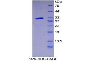SDS-PAGE analysis of Mouse LRIG3 Protein. (LRIG3 蛋白)