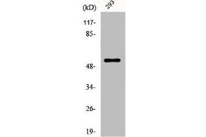 Western Blot analysis of 293 cells using Dematin Polyclonal Antibody (Dematin 抗体)
