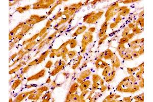 Immunohistochemistry of paraffin-embedded human heart tissue using ABIN7173574 at dilution of 1:100 (TNNI3 抗体  (AA 2-210))