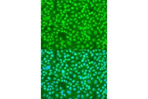 Immunofluorescence analysis of U2OS cells using SRSF9 antibody (ABIN6293561) at dilution of 1:100. (SFRS9 抗体)