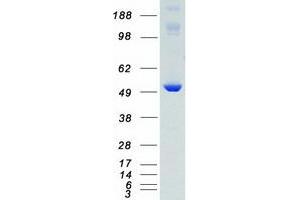 Western Blotting (WB) image for Calcium/calmodulin-Dependent Protein Kinase II delta (CAMK2D) (Transcript Variant 4) protein (Myc-DYKDDDDK Tag) (ABIN2713090)