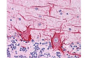 ApoB antibody was used for immunohistochemistry at a concentration of 4-8 ug/ml. (APOB 抗体  (Middle Region))