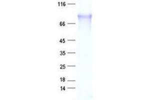 Validation with Western Blot (ZBTB43 Protein (His tag))