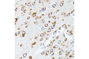 Immunohistochemistry (IHC) image for anti-Ribosomal Protein L7 (RPL7) (AA 1-248) antibody (ABIN6147148)