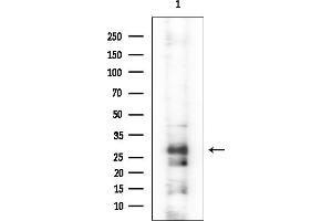 anti-WAP Four-Disulfide Core Domain 1 (WFDC1) antibody