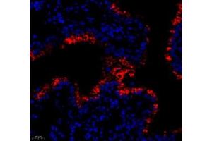 Immunofluorescence (Paraffin-embedded Sections) (IF (p)) image for anti-Mucosal Vascular Addressin Cell Adhesion Molecule 1 (MADCAM1) antibody (ABIN7074695)