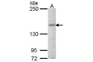 WB Image Sample (30 ug of whole cell lysate) A: NT2D1 5% SDS PAGE antibody diluted at 1:1000 (AHI1 抗体  (N-Term))