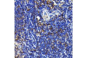 Immunohistochemistry of paraffin-embedded rat spleen using NF-kB p65/RelA antibody (ABIN7268995) at dilution of 1:100 (40x lens). (NF-kB p65 抗体)