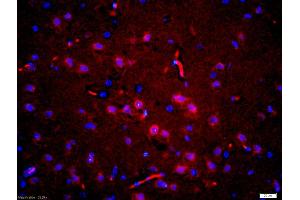 Formalin-fixed and paraffin embedded rat brain labeled with Anti-phospho-Tau protein(Thr181)Polyclonal Antibody, Unconjugated (ABIN1387422) at 1:200 followed by conjugation to the secondary antibody Goat Anti-Rabbit IgG, Cy3 conjugated used at 1:200 dilution for 40 minutes at 37 °C and DAPI staining