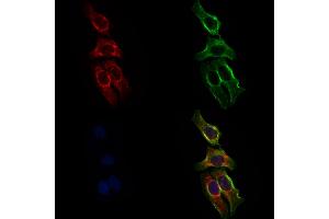 ABIN6258793 and ABIN6275993 staining Hela cells by IF/ICC. (FZD8 抗体  (N-Term))