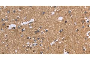 Immunohistochemistry of paraffin-embedded Human brain tissue using KIAA1324 Polyclonal Antibody at dilution 1:30 (ELAPOR1 抗体)