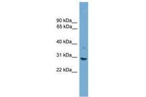 Image no. 1 for anti-Stratifin (SFN) (AA 51-100) antibody (ABIN6745577) (14-3-3 sigma/SFN 抗体  (AA 51-100))