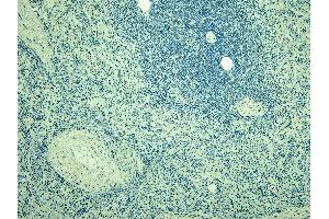 (ABIN184738) Negative Control showing staining of paraffin embedded Human Spleen, with no primary antibody.