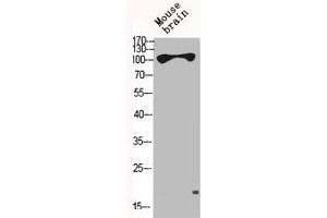Western Blot analysis of MOUSE-BRAIN cells using HXK I Polyclonal Antibody
