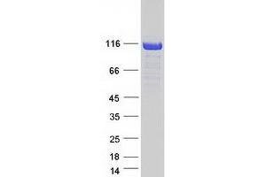 Western Blotting (WB) image for Cylindromatosis (Turban Tumor Syndrome) (CYLD) (Transcript Variant 3) protein (Myc-DYKDDDDK Tag) (ABIN2712748)