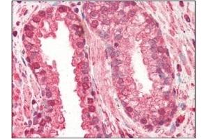 Immunohistochemistry (IHC) image for anti-Cathepsin L1 (CTSL1) (AA 114-333) antibody (ABIN317508) (Cathepsin L 抗体  (AA 114-333))