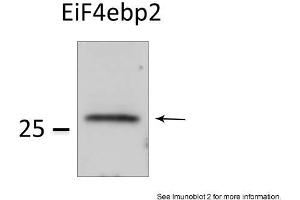 Sample Type: HEK 293 cells (50ug)Primary Dilution: 1:1000Image Submitted by: Veronique DorvalLaval University, Canada . (eIF4EBP2 抗体  (N-Term))