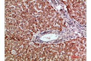 Immunohistochemical analysis of paraffin-embedded human-liver, antibody was diluted at 1:200 (CCL2 抗体  (AA 31-80))