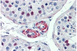 Human Testis: Formalin-Fixed, Paraffin-Embedded (FFPE) (KIF13B 抗体  (AA 107-156))