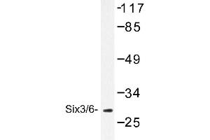 Image no. 1 for anti-Sine Oculis-Related Homeobox 3 (SIX3) antibody (ABIN272150) (SIX3 抗体)