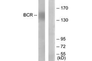 Western blot analysis of extracts from K562 cells, using Bcr (Ab-177) Antibody. (BCR 抗体  (AA 144-193))