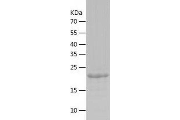 PHF10 Protein (AA 153-401) (His tag)